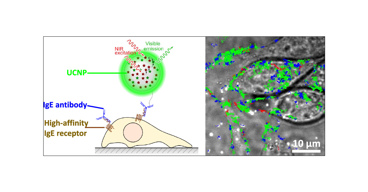 srijayee_ghosh's tweet card. Single particle tracking (SPT) is a powerful technique for real-time microscopic visualization of the movement of individual biomolecules within or on the surface of living cells. However, SPT often...