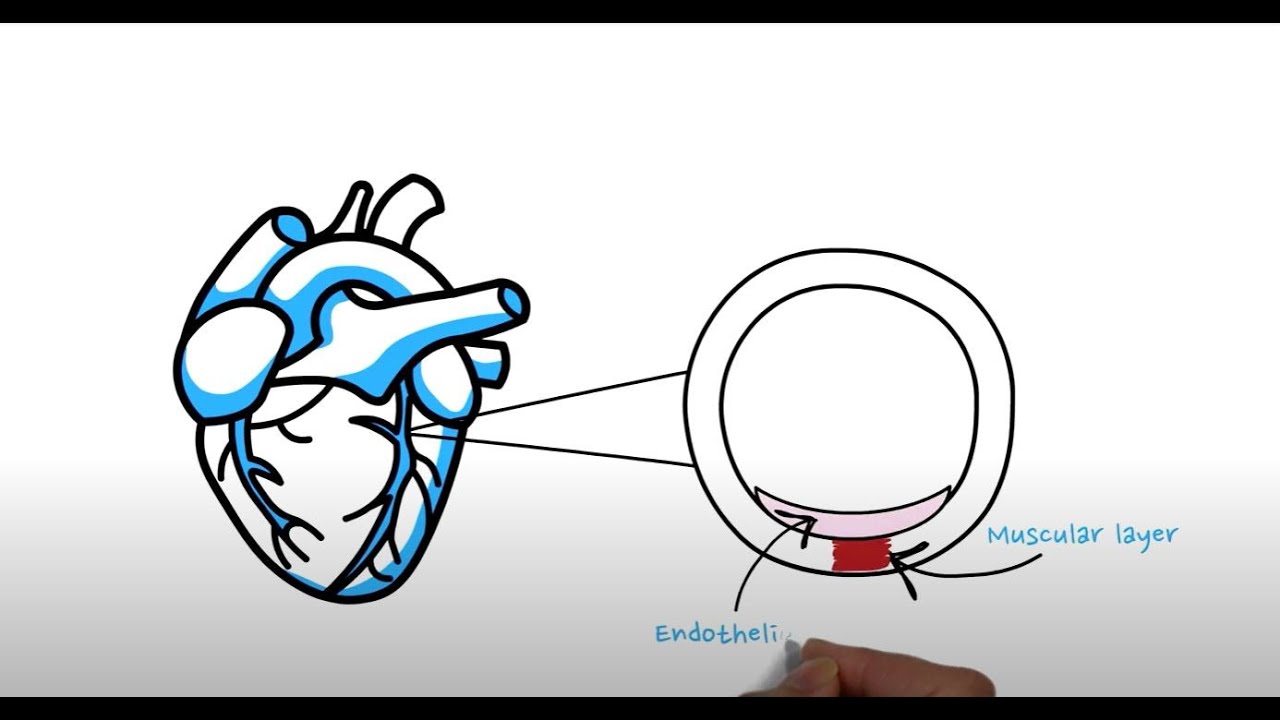 DrRumberger's tweet card. What is a Coronary Calcium Score?