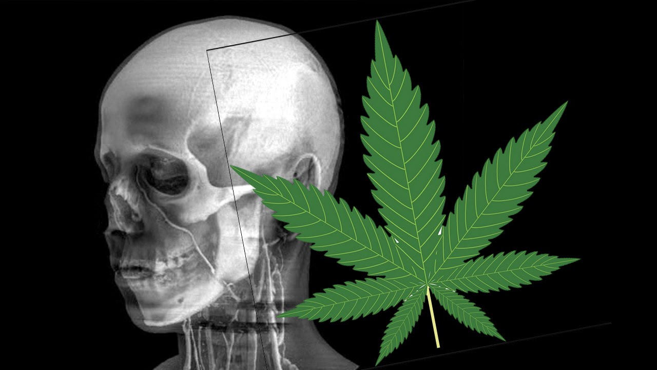 TConspiracyChef's tweet card. Marijuana Use Shrinks The Brain, Study Shows