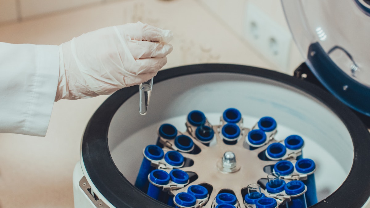 CLINIMED's tweet card. Researchers discovered that while ethanol can aid in a gradual release of growth factors in PRP, there is no significant improvement in growth factors in activating PRP.