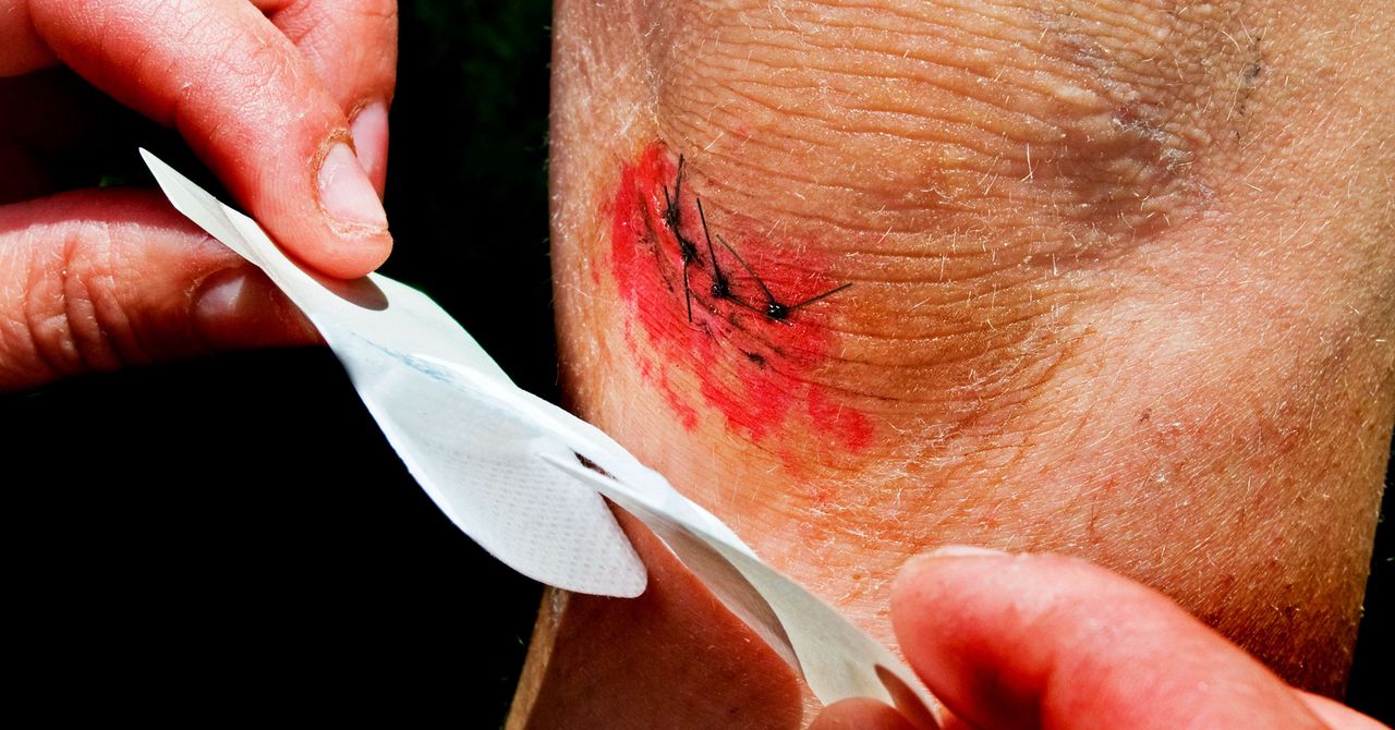 AgtechTutor's tweet card. Keeping wounds covered can help them stay clean. But if bacteria grow beneath the bandages, things can get dangerous.