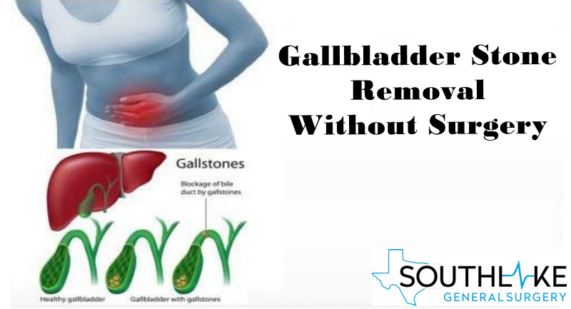 digiwibes's tweet card. Afraid of gallbladder treatment surgery but suffering from extreme pain? Scar tissue after gallbladder surgery. Best Surgeon for Gallbladder surgery.