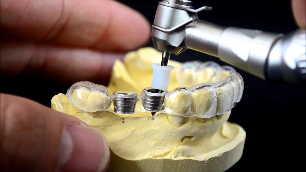 3d_post's tweet card. Case study: Dentistry in the Digital age Advancements in technologies help many industries improve their efficiency and productivity, and the dental industry is no different. New revolutionary...