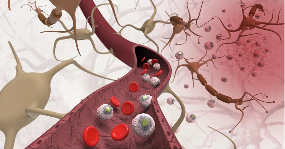 veena_manuel's tweet card. Researchers at MIT have invented "Circulatronics," a medical platform they say enables non-invasive treatment of neuroinflammation.