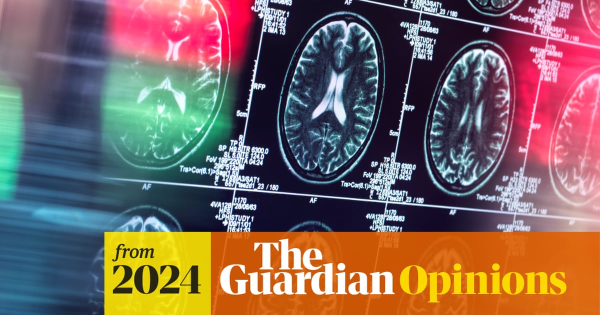 guardian's tweet card. Neuroimaging studies have shown that the amygdala, the tiny almond-shaped brain structure that mediates fear, is larger in people with more rightwing views