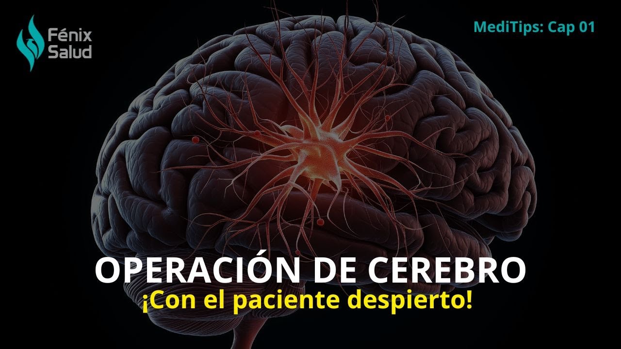 Fenixsalud_ccs's tweet card. MediTips Capitulo N° 1 ¿Operar el cerebro de un paciente mientras...
