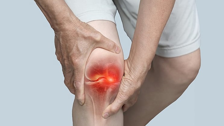 KannadaPrabha's tweet card. ಸಂಧಿವಾತವು ವಿಶ್ವಾದ್ಯಂತ ಕಂಡುಬರುವ ಅತ್ಯಂತ ಸಾಮಾನ್ಯವಾದ ಆರೋಗ್ಯ ಸಮಸ್ಯೆಗಳಲ್ಲಿ ಒಂದಾಗಿದೆ. ಇದು ದೀರ್ಘಕಾಲದ ನೋವು, ಬಿಗಿತ ಮತ್ತು ಚಲನಶೀಲತೆಗೆ ತೊಂದರೆಯನ್ನುಂಟುಮಾಡುತ್ತದೆ. ಅಸ್ಥಿಸಂಧಿವಾತದ