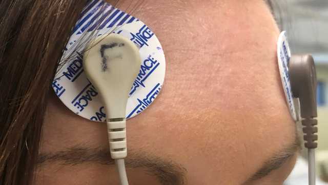 IntlBipolar's tweet card. Patient, doctor shares insight on Electroconvulsive Therapy