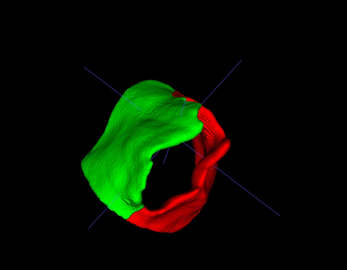 ProjectMONAI's tweet card. Auto3DSeg is a MONAI native project aiming to demonstrate best practices of common 3D segmentation workflows for several algorithms.