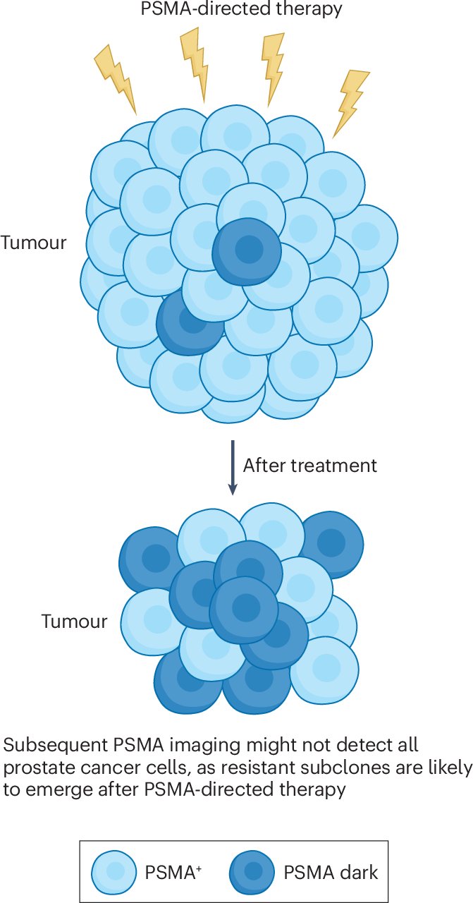 AdamSharpMedOnc's tweet card. Nature Reviews Urology - Prostate-specific membrane antigen (PSMA) as a theranostic agent is driving changes in prostate cancer including both clinical development of new drugs and clinical care....