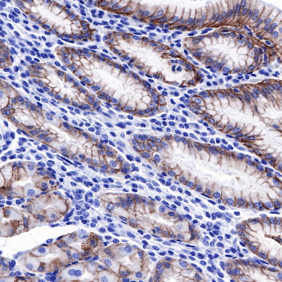 AntBio_'s tweet card. Product Specification Host Goat Clone Number N/A Antibody Type pAb Application IHC-P Reactivity Ms, Rb Purification Protein A Conjugation HRP Physical Appearance Liquid Stability & Storage 12 month...