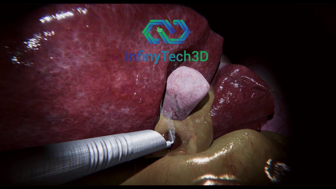 infinyTech3D's tweet card. InfinyTech3D - 2021-2022 Retrospective