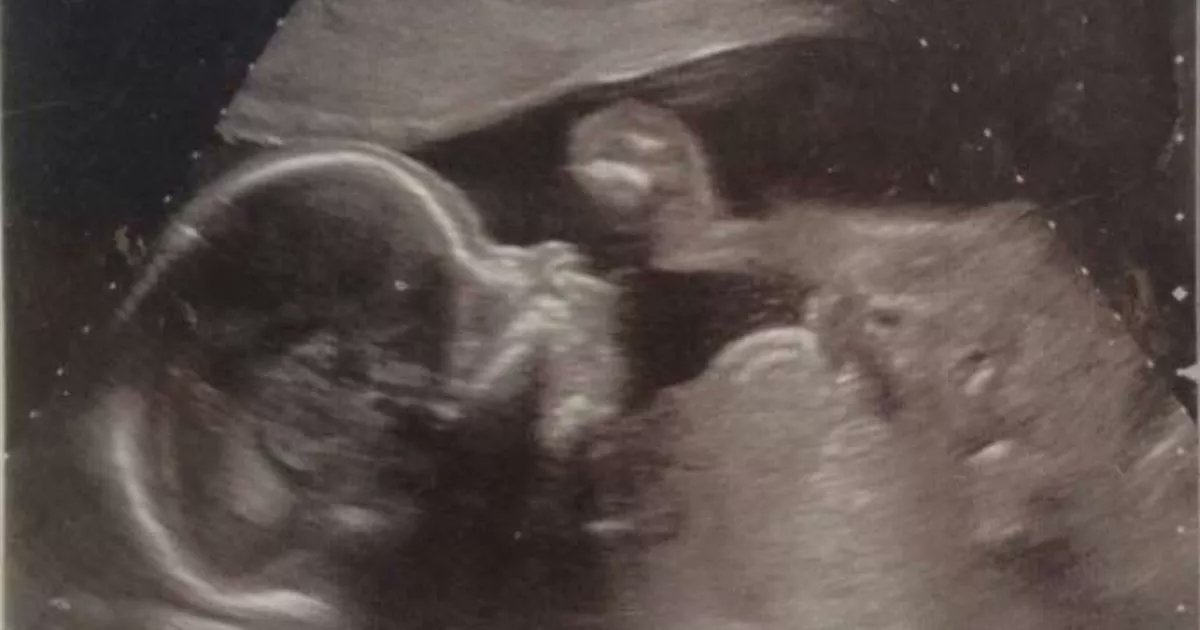 Kennedy__News's tweet card. EXCLUSIVE: Ruth Ratcliff, 26 believes the unexpected appearance was a sign from her late nan to let her know she was there for her during her first pregnancy