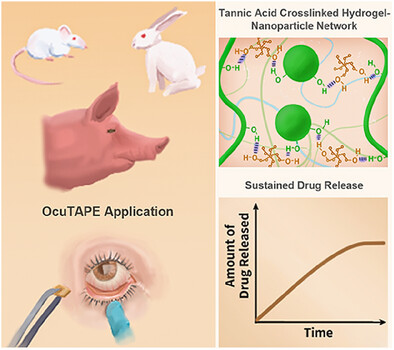 DrPawanKSingh's tweet card. A drug-eluting ocular patch is developed using tannic acid (TA) to bridge micellar nanoparticles (NPs) within a hydrogel network, enabling strong adhesion to wet tissue and prolonged drug release....