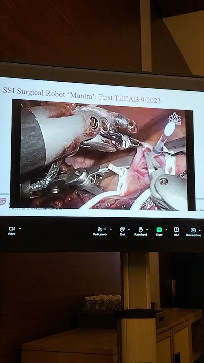 sujatawde's tweet card. Robotic Cardiac Care #medical #trending #youtubeshorts #shortsfeed...