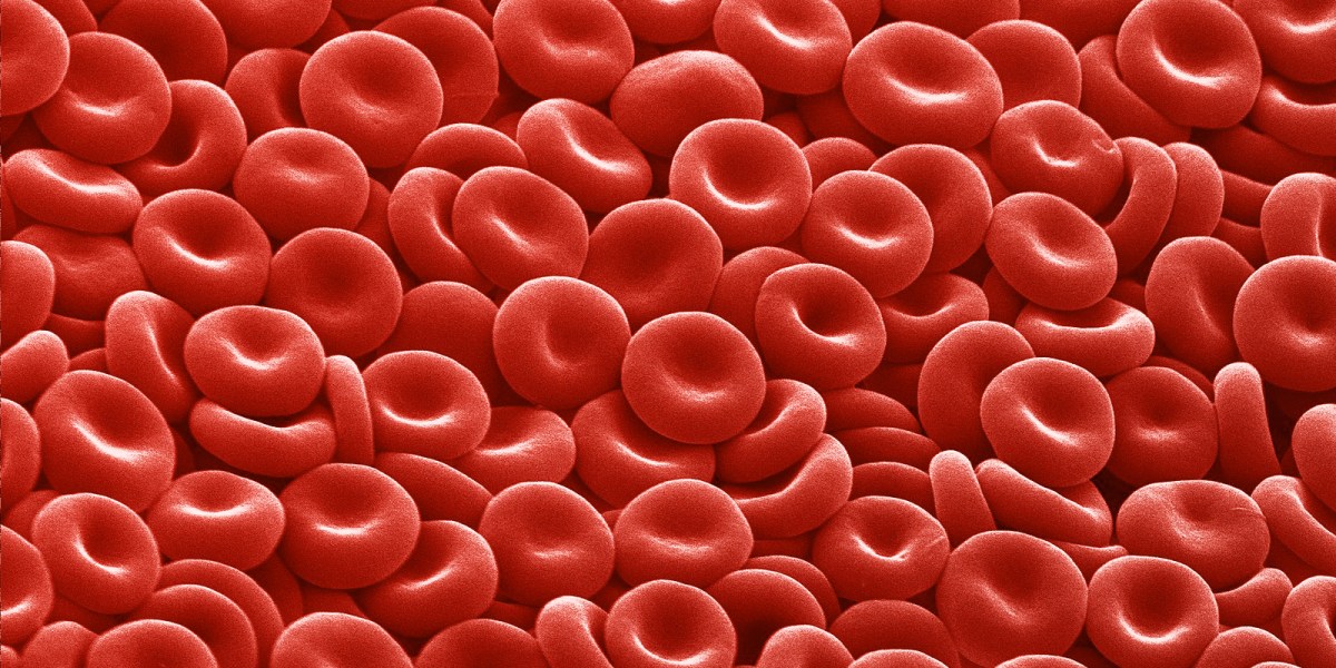 basharai's tweet card. The era of editing human genes to treat inherited disease has arrived. That’s according to a pair of biotech companies that say they’ve eliminated painful symptoms from two patients with blood...