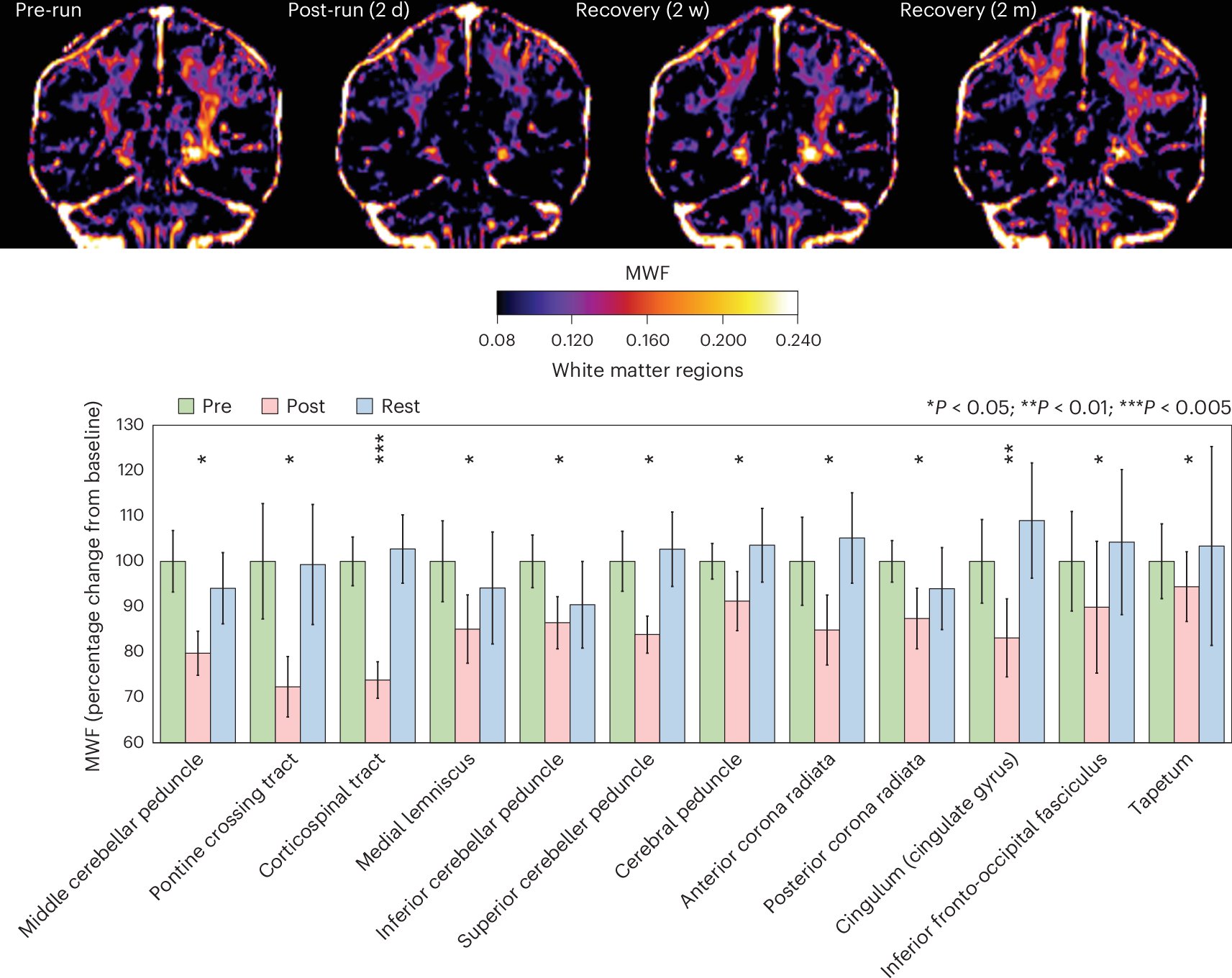 SENC_'s tweet card. Nature Metabolism - Using magnetic resonance imaging on marathon runners, Ramos-Cabrer, Cabrera-Zubizarreta et al. report that the signal detected as a surrogate of myelin content is significantly...