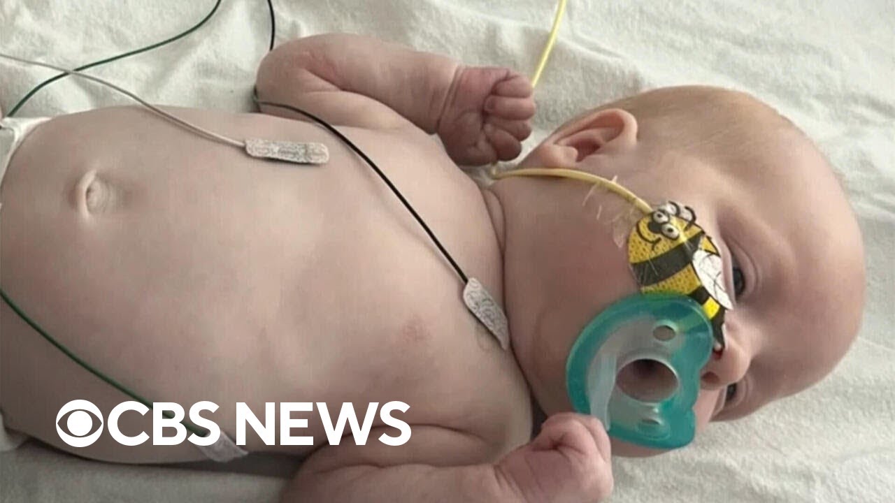 Justmomo_studio's tweet card. Breakthrough in gene-editing therapy helps baby with rare disorder