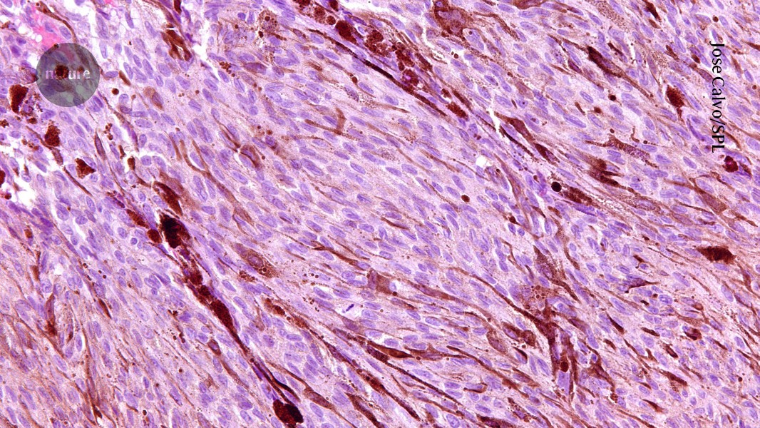 Nature's tweet card. Nature - Mice that exercised produced higher levels of an immune-cell-stimulating molecule than sedentary rodents did.