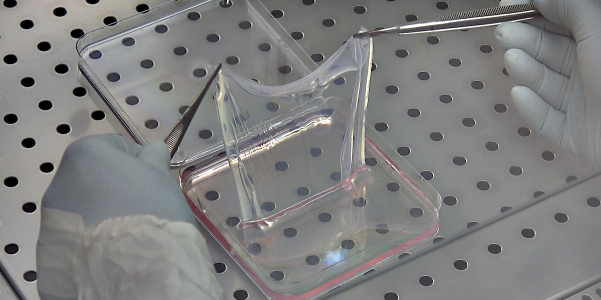 EasyInve's tweet card. Lo Stato non sembra voler investire per sostenere Holostem, che ha sviluppato una cura per una grave e rara malattia della pelle