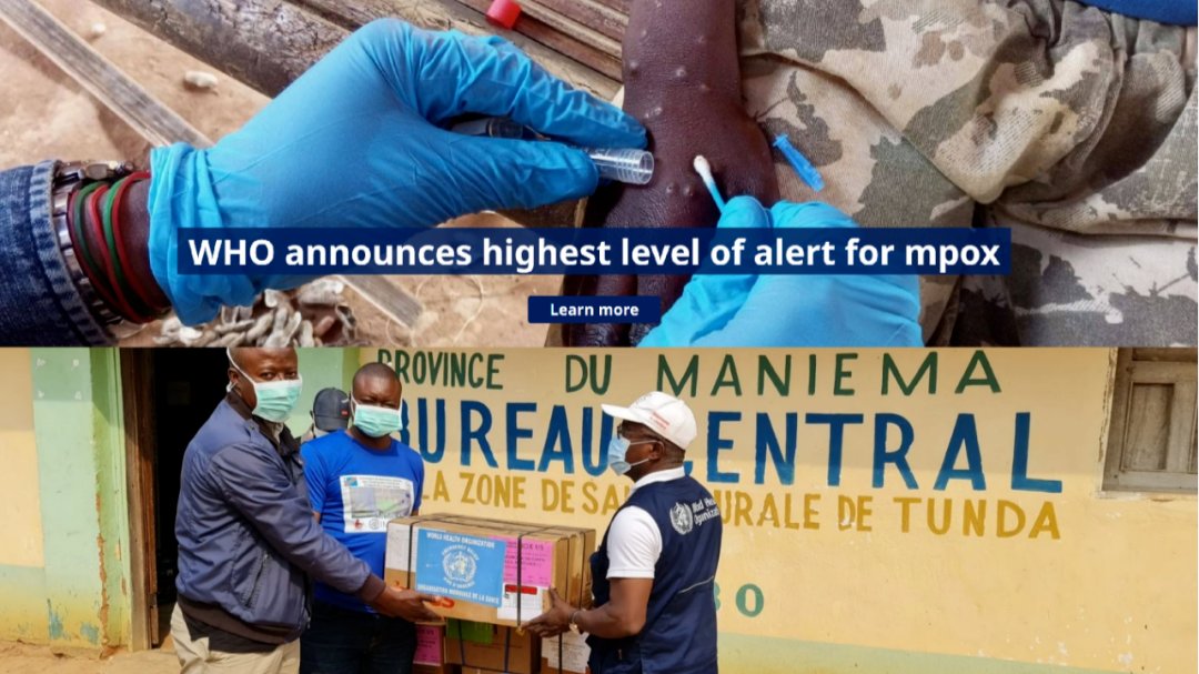 igenetech's tweet card. Since 2022, the global community has witnessed an unprecedented surge in monkeypox cases, driven by the rapid spread of the highly transmissible Clade IIb variant in non-endemic regions, followed by...