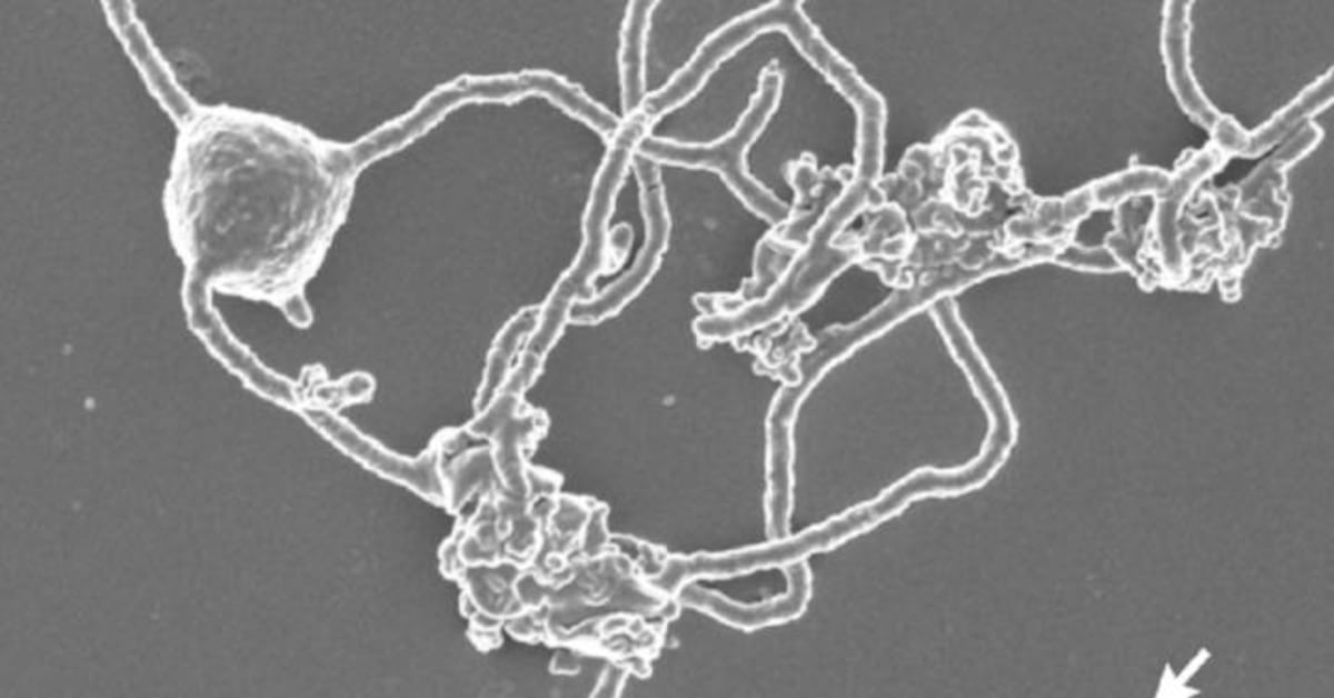 el_pais's tweet card. Científicos japoneses observan por primera vez arqueas de Asgard, microbios cuyos ancestros dieron el primer paso para la aparición de animales y plantas hace 2.000 millones de años