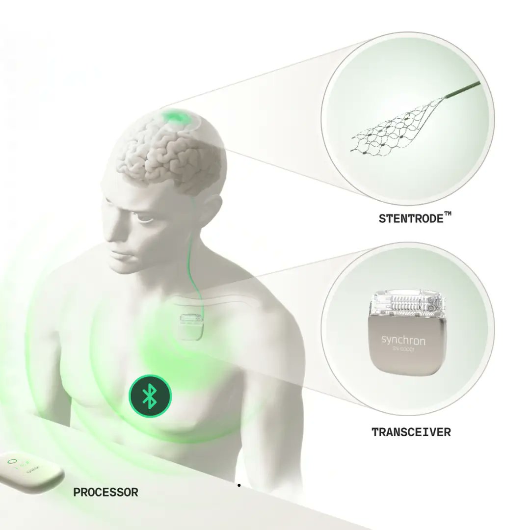 GuidedSolutions's tweet card. Medical Device News by Guided Solutions | US-based Synchron has secured $200m in a Series D funding round to drive the commercial rollout of its Stentrode brain-computer interface (BCI) platform