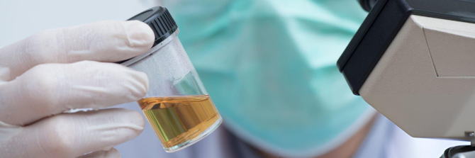 hhlwu's tweet card. The following is a summary of “Evaluation of urinary volatile organic compounds as a novel metabolomic biomarker to assess…