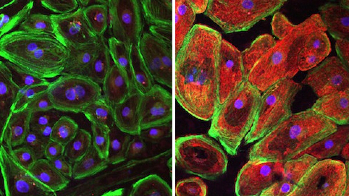 CRSM_UTSW's tweet card. A new gene-editing technique developed in North Texas shows promise in stunting Duchenne muscular dystrophy, a severe genetic disorder that affects about…
