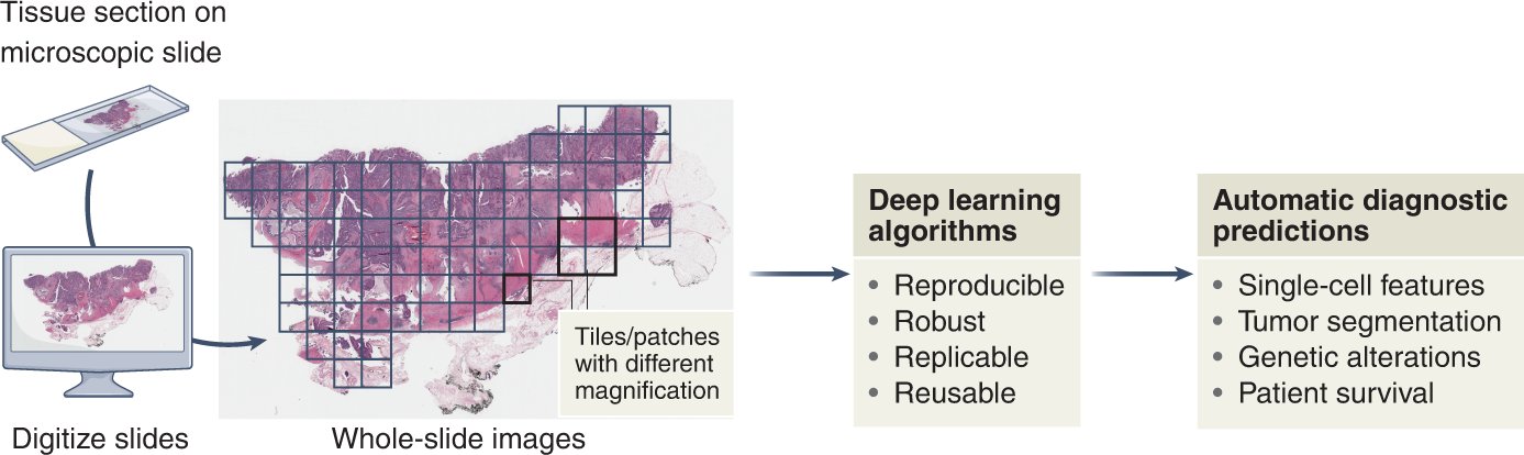 NatureMedicine's tweet card. Nature Medicine - Greater emphasis on reproducibility and reusability will advance computational pathology quickly and sustainably, ultimately optimizing clinical workflows and benefiting patient...