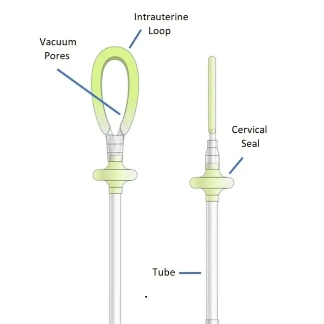 GuidedSolutions's tweet card. Medical Device News by Guided Solutions | Organon is selling its JADA post-partum haemorrhage (PPH) treatment system to Laborie Medical in a deal valued at up to $465m. The US-based company will