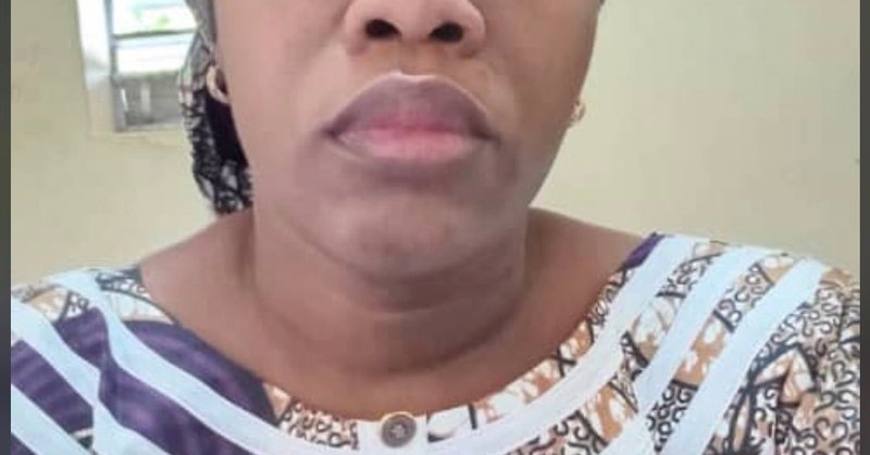 Tweet card summary image