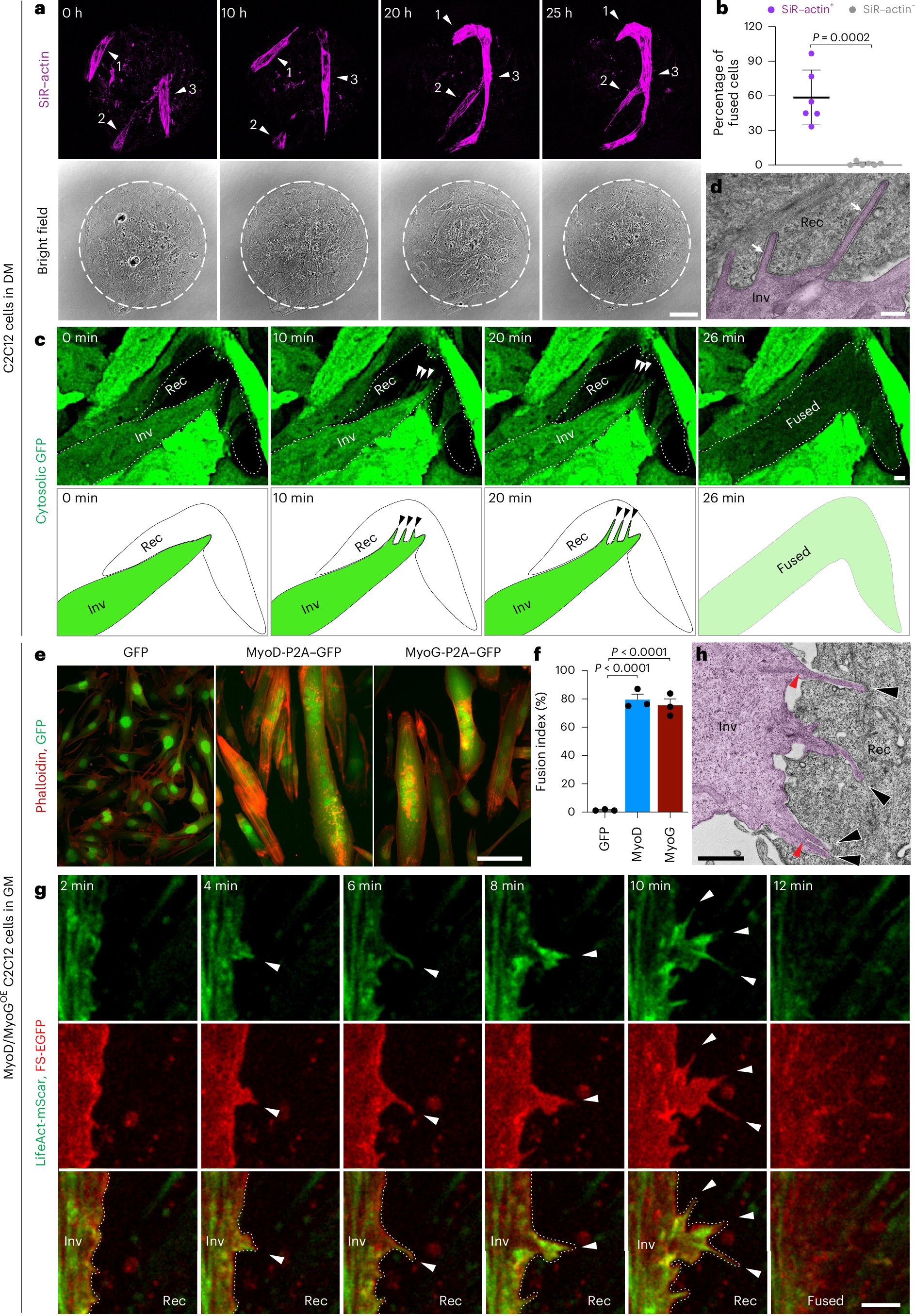 NatureCellBio's tweet card. Nature Cell Biology - Lu et al. reveal the spatiotemporal coordination between two nucleation-promoting factors, WAVE and N-WASP, and two actin-bundling proteins, dynamin and WIP, in generating...