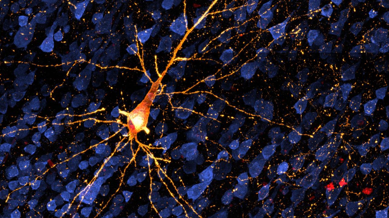 CNPRCresearch's tweet card. Research in nonhuman primates is opening the possibility of testing treatments for the early stages of Alzheimer’s and similar diseases, before extensive brain cell death and dementia set in. A study...