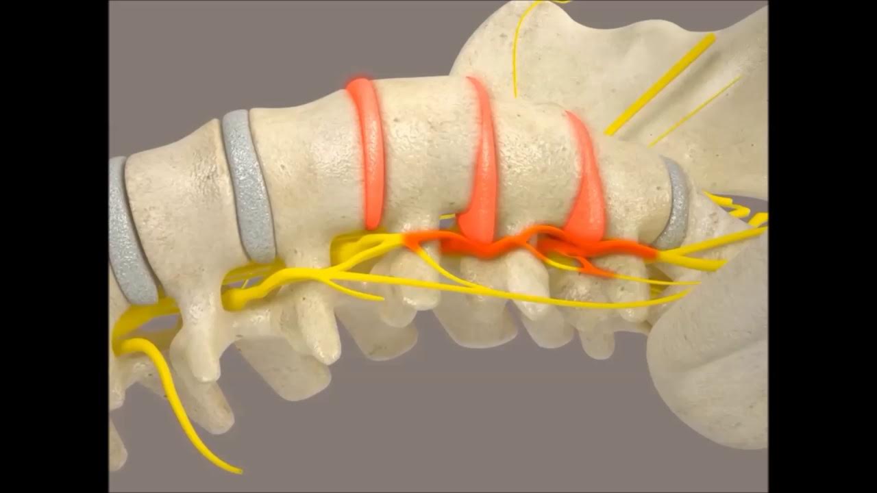 FTRManuelTerapi's tweet card. How Lumbar and Cervical Spinal Traction Works?