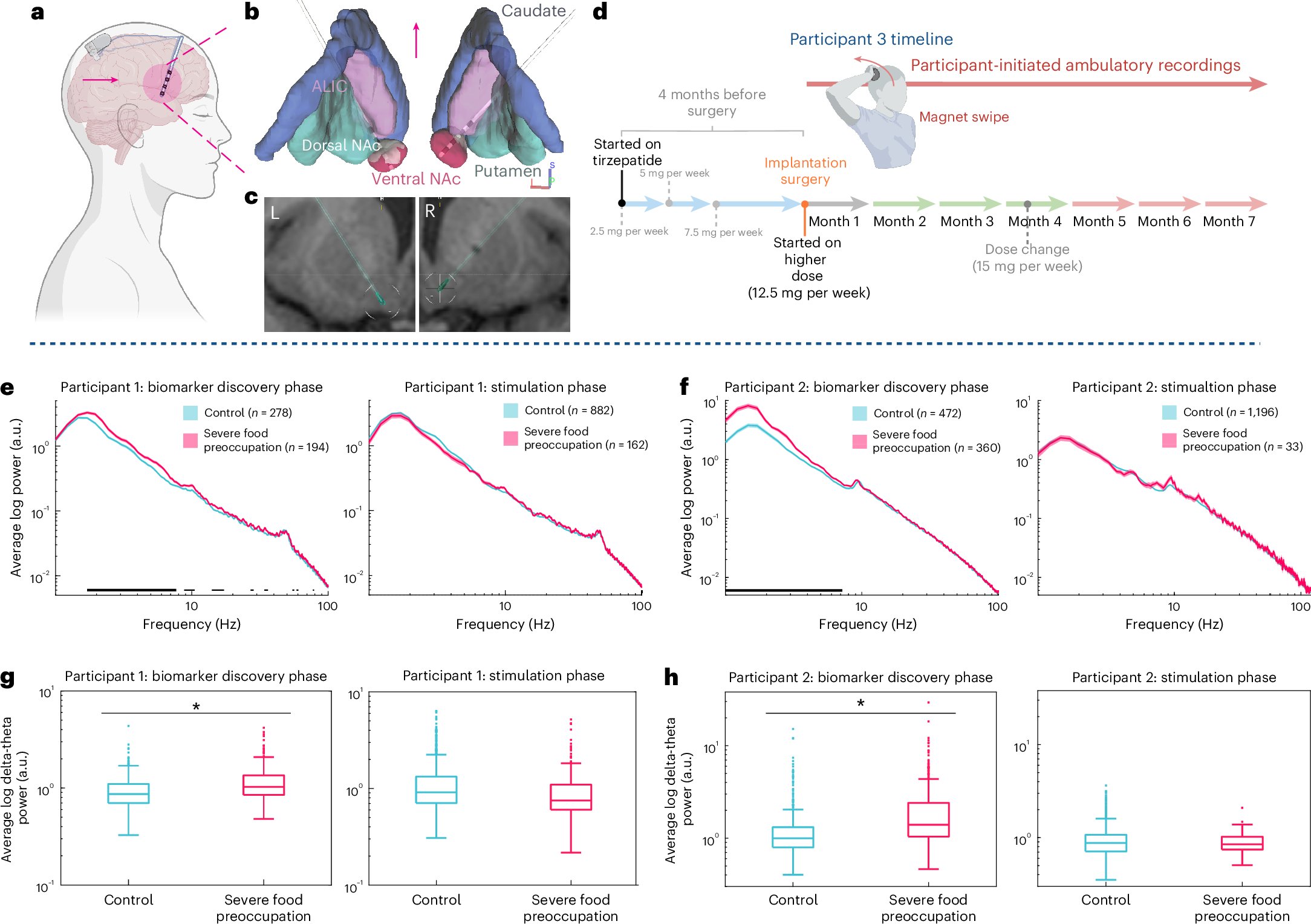 Loose_Lab_Rat's tweet card. Nature Medicine - This study provides the first evidence in humans that tirzepatide modulates brain electrophysiology, with changes in low-frequency accumbens power linked to food preoccupation.