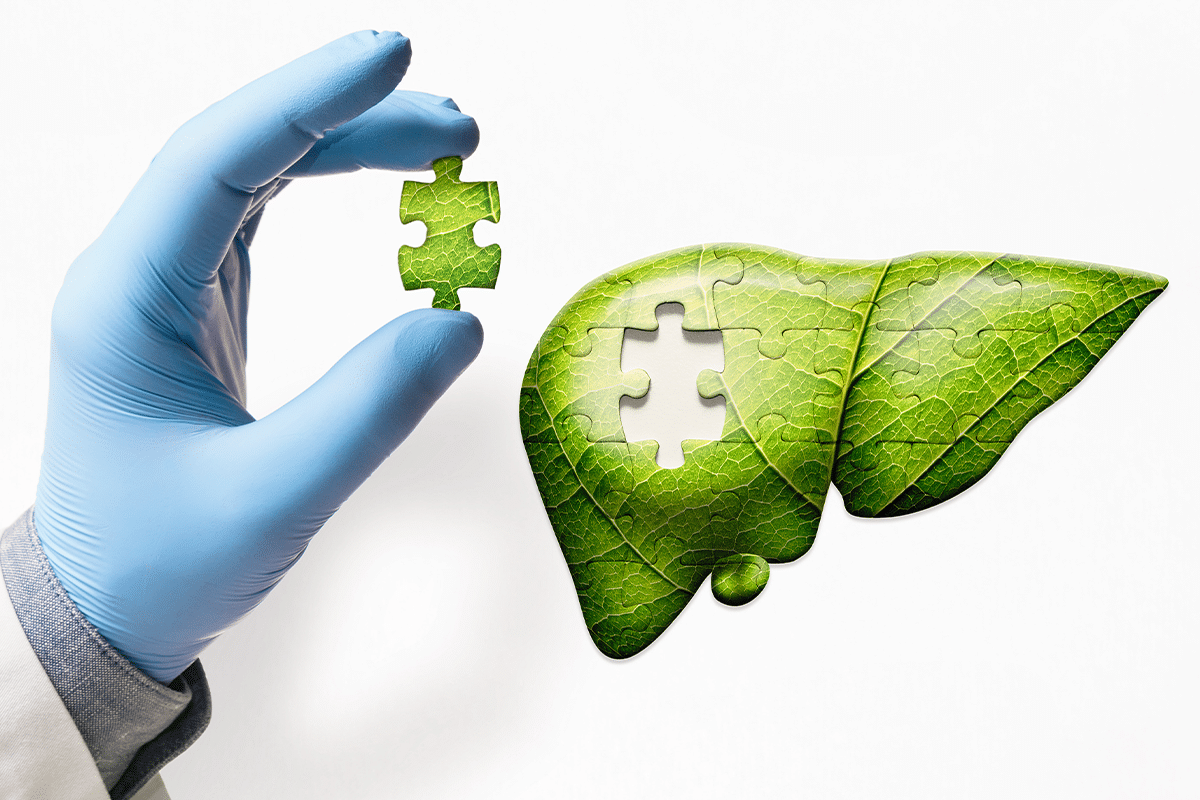 cmeoutfitters's tweet card. In this CME Outfitters Snack on metabolic dysfunction-associated steatotic liver disease (MASLD) / metabolic-associated steatohepatitis (MASH), expert faculty turn attention to treatment planning for...