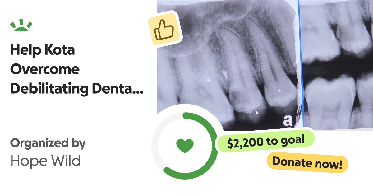 todivinefire's tweet card. Hey guys, This is Kota. I recently went to the dentist because of the intense p… Hope W needs your support for Help Kota Overcome Debilitating Dental Pain