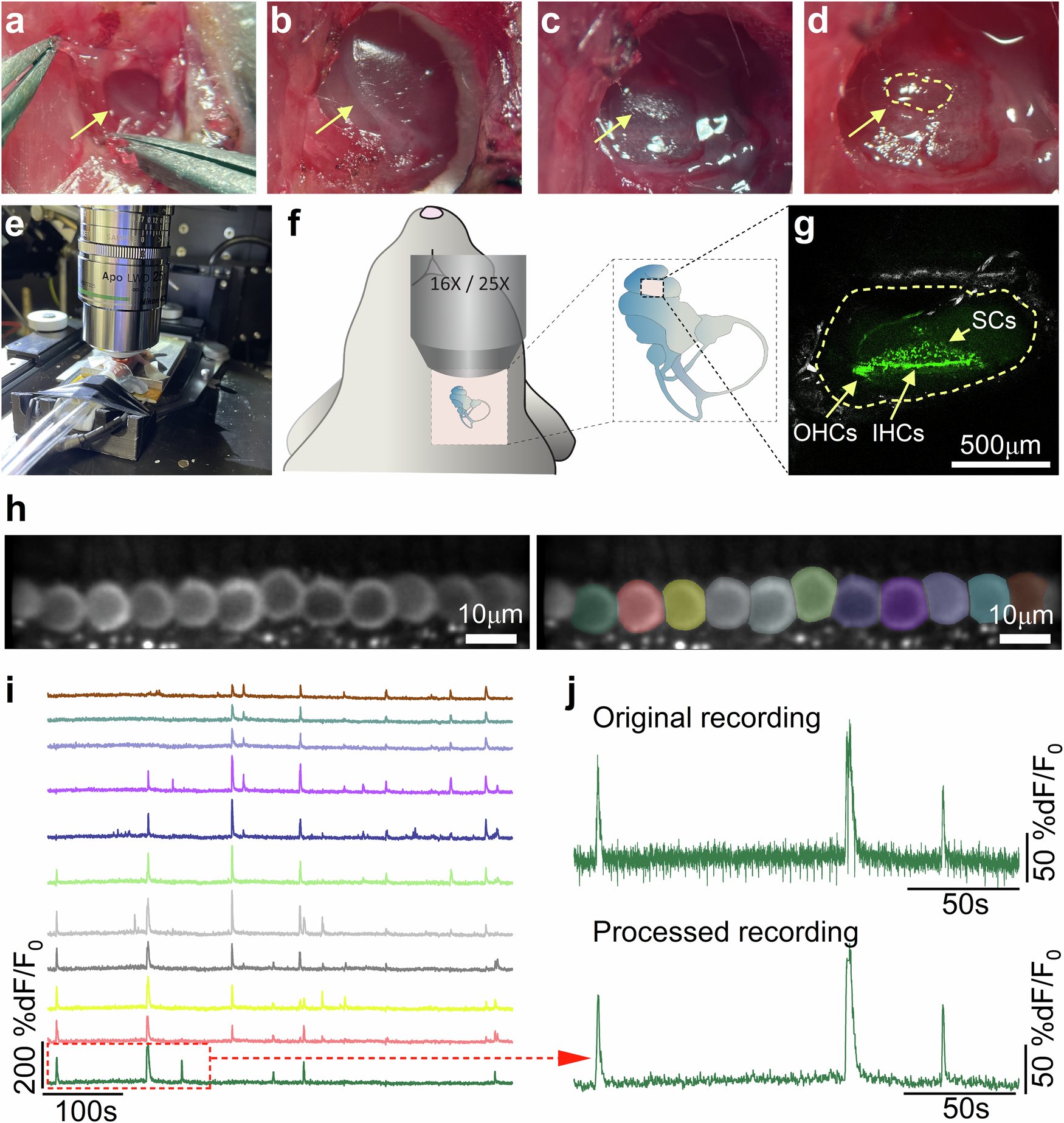 FrancescaDeFav1's tweet card. Nature Communications - Mechanisms underlying the initiation and modulation of the firing activity in the cochlea and its dynamics in vivo are not fully understood. Here, the authors investigate...