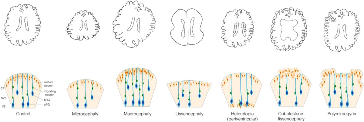 KalebicNereo's tweet card. The cerebral cortex is a structure that underlies various brain functions, including cognition and language. Mammalian cerebral cortex starts developing duri...