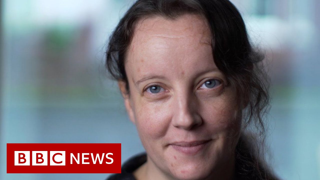 minzhang3's tweet card. Why do some women wait decades for an ADHD diagnosis? - BBC News
