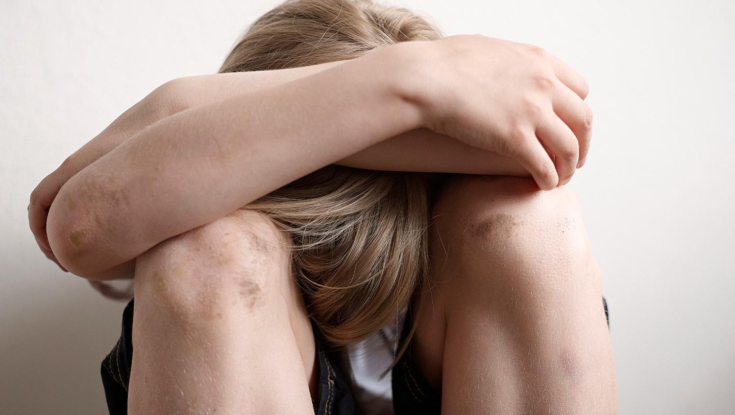 Flickaplattform's tweet card. 36 tjej- trans- och ungdomsorganisationer: Behovet är större än någonsin – men politikerna vill inte satsa på oss