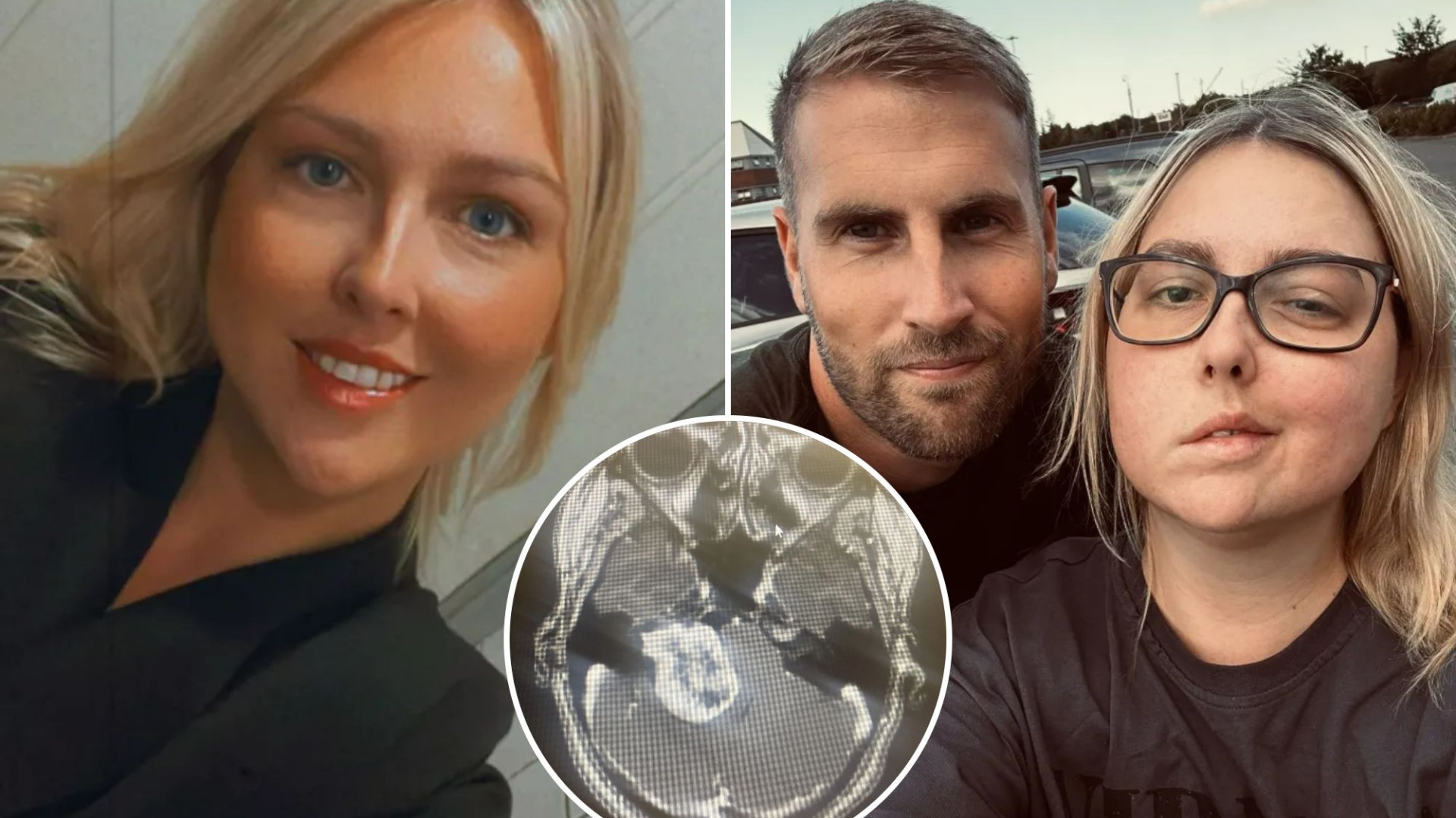 Kennedy__News's tweet card. WHEN Tamara Bright began suffering severe headaches and balance issues, her GP initially blamed her contraception. It wasn’t until a decade later, when the 31-year-old mum-of-one’s hearing be…