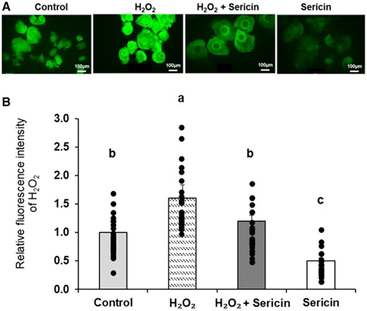 MHR_ReprodSci's tweet card. Abstract. Antioxidants are free radical scavengers that increase oocyte quality and improve female fertility by suppressing oxidative stress. However, the
