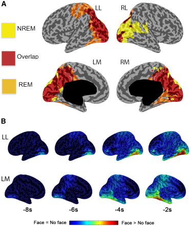 leafs_s's tweet card. The paper by Tononi et al. discusses what sleep reveals about the substrate of consciousness, how experience can vanish during sleep, and how dreams can be supported by a brain largely disconnected...
