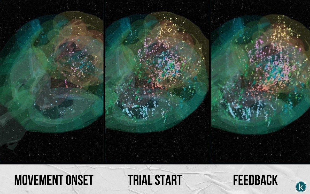 kazinform_eng's tweet card. An international team of neuroscientists has unveiled the most detailed map of brain activity during decision-making. The studies, published in Nature, brought together 12 laboratories across the...