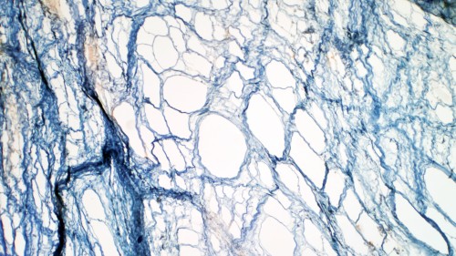 nano_jenn's tweet card. This Collection aims to highlight fundamental and translational advances in ECM mechanobiology.