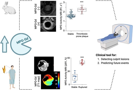 docnadel's tweet card. AbstractAims. Unstable atherosclerotic plaques have increased activity of myeloperoxidase (MPO). We examined whether molecular magnetic resonance imaging (