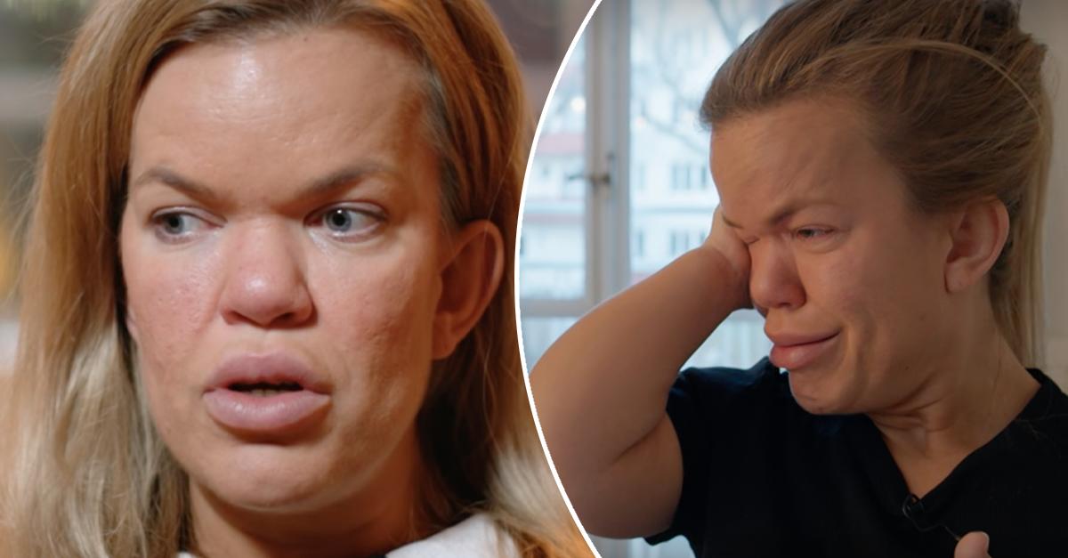 PeterModerat's tweet card. Sanna Dollan har gett upp drömmen om att få egna barn. I programmet ”Min ångest och jag” bryter hon flera gånger ihop i tårar när hon pratar om ensamheten hon