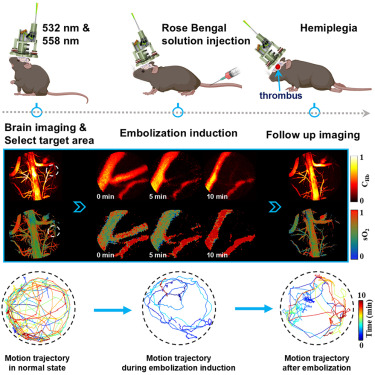 CellRepPhysSci's tweet card. Liang et al. present a wearable photoacoustic microscope for real-time, high-resolution imaging of cerebral blood oxygen and hemoglobin in freely moving mice. It enables precise stroke modeling,...